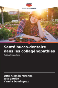 Santé bucco-dentaire dans les collagénopathies