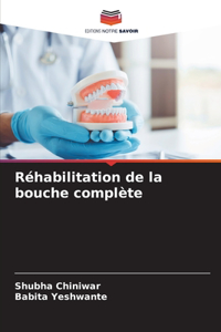 Réhabilitation de la bouche complète