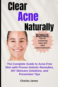 Clear Acne Naturally