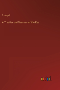 Treatise on Diseases of the Eye