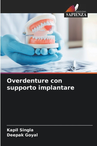 Overdenture con supporto implantare