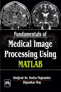 Fundamentals Of Medical Image Processing Using