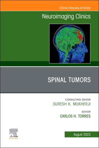 Spinal Tumors, an Issue of Neuroimaging Clinics of North America