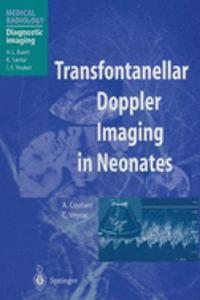 Transfontanellar Doppler Imaging in Neonates