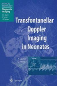 Transfontanellar Doppler Imaging in Neonates