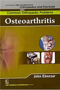 Osteoarthritis (Handbooks In Orthopedics And Fractures Series, Vol. 87 -Common Orthopedic Problems)