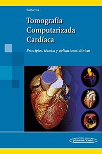 Tomografia computarizada cardiaca. Principios, tecnica y aplicaciones clinicas