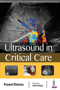 Ultrasound in Critical Care