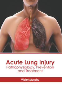 Acute Lung Injury: Pathophysiology, Prevention and Treatment