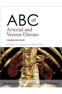 ABC of Arterial and Venous Disease