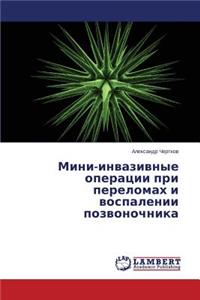 Mini-Invazivnye Operatsii Pri Perelomakh I Vospalenii Pozvonochnika