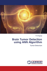 Brain Tumor Detection using ANN Algorithm