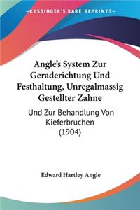 Angle's System Zur Geraderichtung Und Festhaltung, Unregalmassig Gestellter Zahne