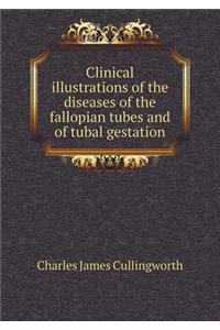 Clinical Illustrations of the Diseases of the Fallopian Tubes and of Tubal Gestation