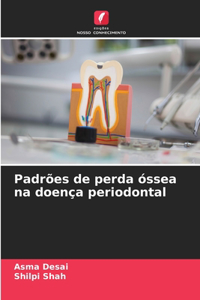 Padrões de perda óssea na doença periodontal