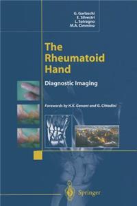 The Rheumatoid Hand