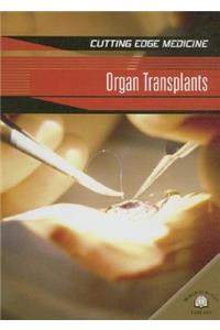 Organ Transplants