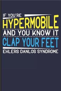 If You're Hypermobile and You Know it Clap Your Feet