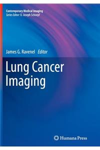 Lung Cancer Imaging