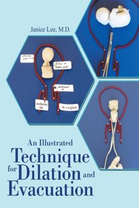 Illustrated Technique for Dilation and Evacuation