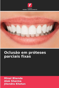 Oclusão em próteses parciais fixas