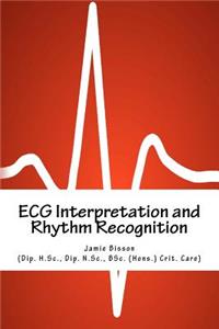 ECG Interpretation and Rhythm Recognition