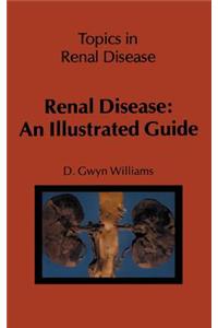 Renal Disease: An Illustrated Guide