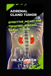 Adrenal Gland Tumor