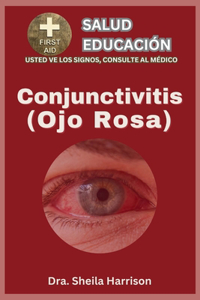 Ojo rosa (conjuntivitis)