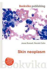 Skin Neoplasm
