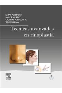 Técnicas Avanzadas En Rinoplastia