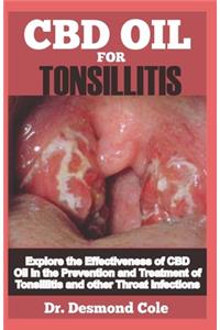 Tonsillitis: Explore the Effectiveness of CBD Oil in the Prevention and Treatment of Tonsillitis and other Throat Infections