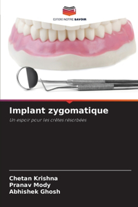 Implant zygomatique