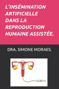 L'Insémination Artificielle Dans La Reproduction Humaine Assistée.