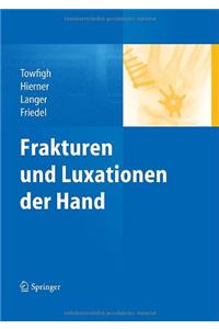 Frakturen Und Luxationen Der Hand