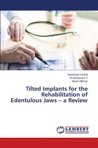 Tilted Implants for the Rehabilitation of Edentulous Jaws - a Review
