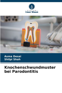 Knochenschwundmuster bei Parodontitis