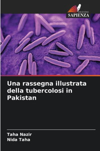 Una rassegna illustrata della tubercolosi in Pakistan