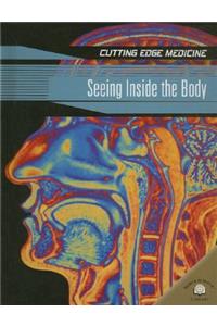 Seeing Inside the Body