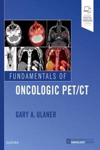 Fundamentals of Oncologic Pet/CT