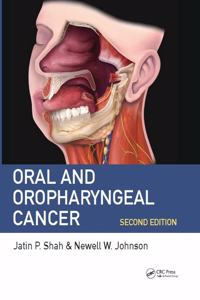 Oral And Oropharyngeal Cancer