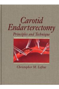 Carotid Endarterectomy: A Technical Atlas