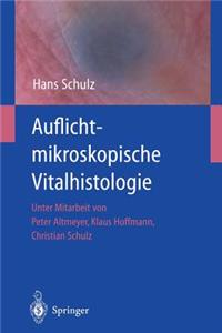 Auflichtmikroskopische Vitalhistologie