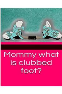 Mommy what is clubbed foot?