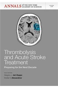 Thrombolysis and Acute Stoke