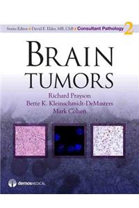 Brain Tumors