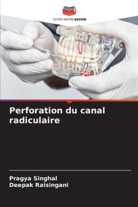 Perforation du canal radiculaire