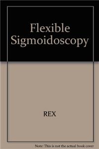 Flexible Sigmoidoscopy