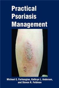 Practical Psoriasis Management