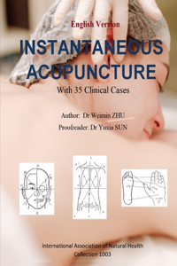 Instantaneous Acupuncture